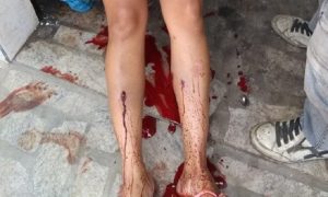 Bandidos erram o alvo e atingem mulher em Teixeira de Freitas