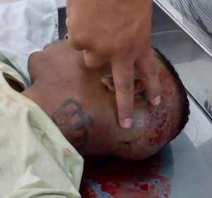 Prado: Jovem baleado na feirinha do Prado morre ao dar entrada na UPA