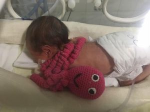 Polvos de crochê ajudam na recuperação de bebês prematuros em Porto Seguro