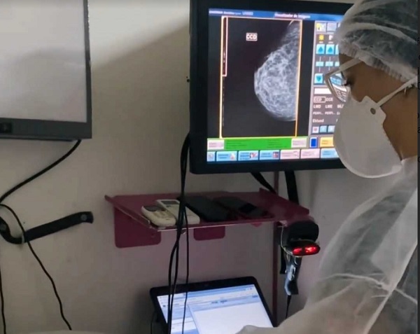 Mamografias realizadas no Caminhão de Rastreamento podem ser retiradas na Sesau