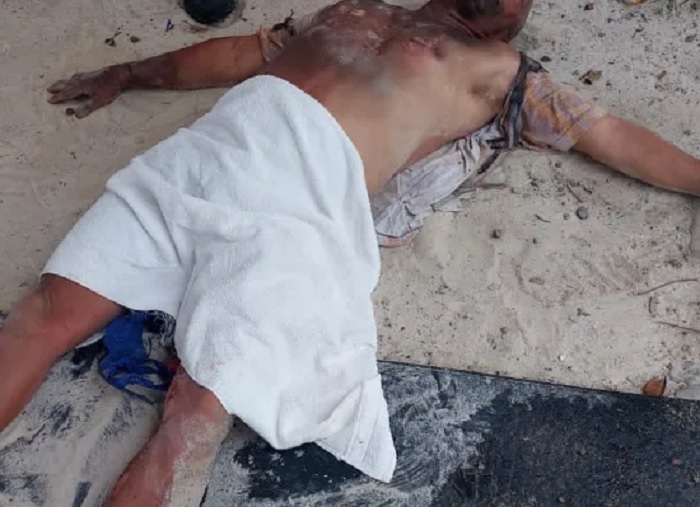 Homem sobrevive após ser atingido por raio em Teixeira de Freitas