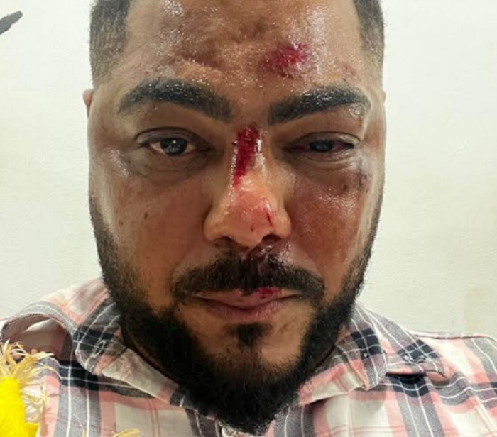 Blogueiro é ferido ao tentar separar briga em festa junina em Teixeira de Freitas