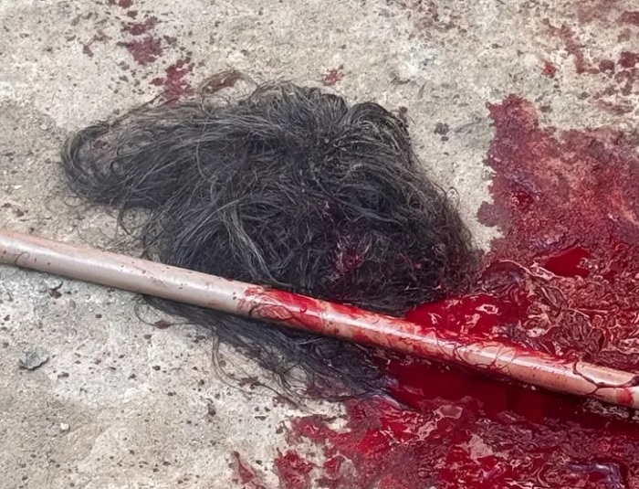 Mulher fica gravemente ferida após ser atacada por cachorro em Itagimirim Mulher fica gravemente ferida após ser atacada por cachorro em Itagimirim